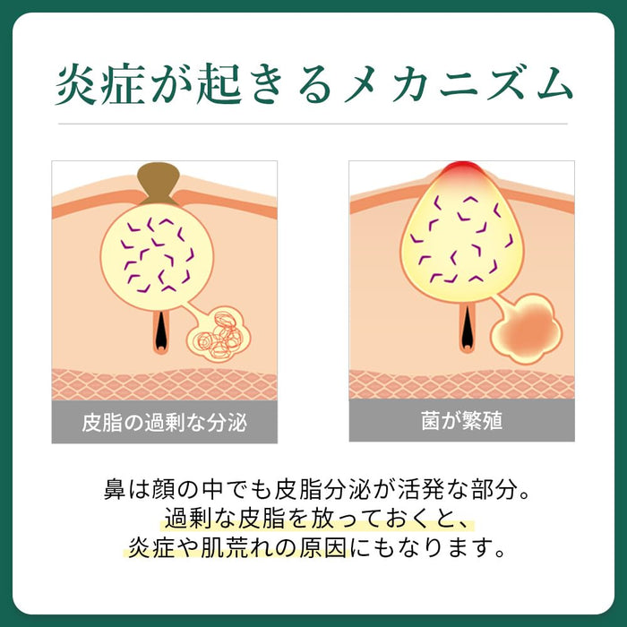 Takeuchi Pharmaceutical Cica Hydrocolloid Nose Acne Patch with Tea Tree